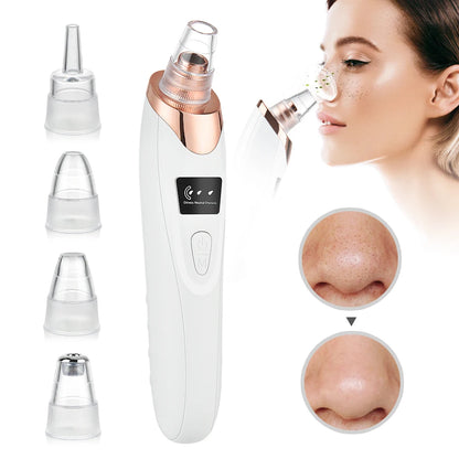 Electric Vacuum Blackhead Remover – EMS Ultrasonic Skin Scrubber