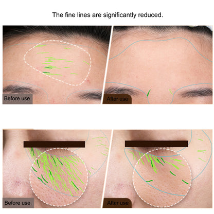 EMS Facial Body RF Machine – Face Lifting & Skin Tightening Device