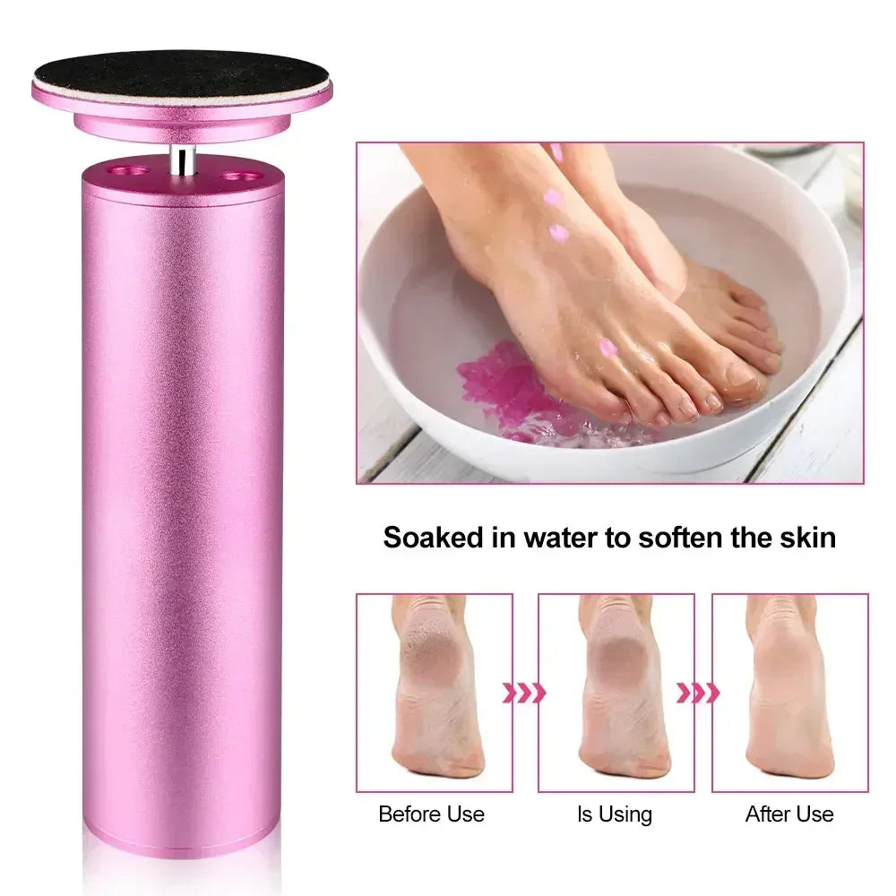 Electric Foot Callus Remover – Electronic Foot Grinder Tool