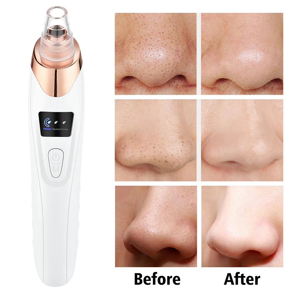 7 In 1 EMS Face Lifting Device – LED Facial Massager & Pore Vacuum