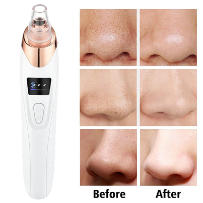 7 In 1 EMS Face Lifting Device – LED Facial Massager & Pore Vacuum