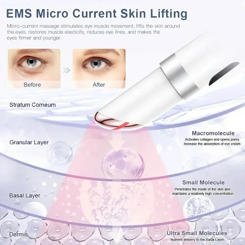 Electric Eye Massager EMS Microcurrent – Wrinkle & Dark Circle Care