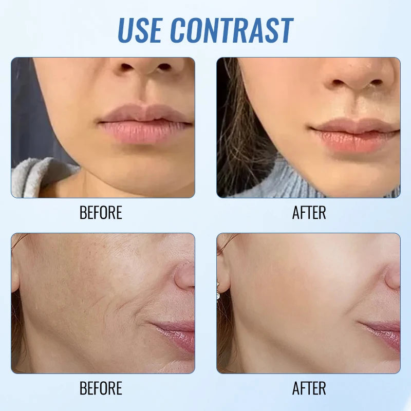 7 in 1 Face Lifting Device – EMS LED Facial & Neck Massager